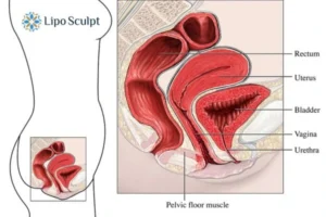 Treatment For A Leaky Bladder 2 How EM Chair treatment Amersham can help Leaky bladder issues. Read more now!
