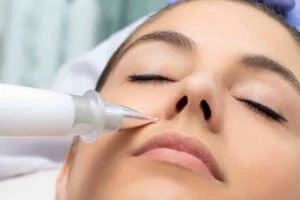 Best Actinic Keratoses Removal 3 Actinic keratoses Amersham solutions - book in today!