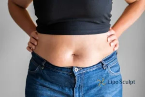 Do you wish you could reduce your muffin top Amersham With Aqualy fat dissolving injections you can!